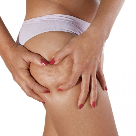 How to Fight Cellulite: Secrets to Smooth and Firm Skin